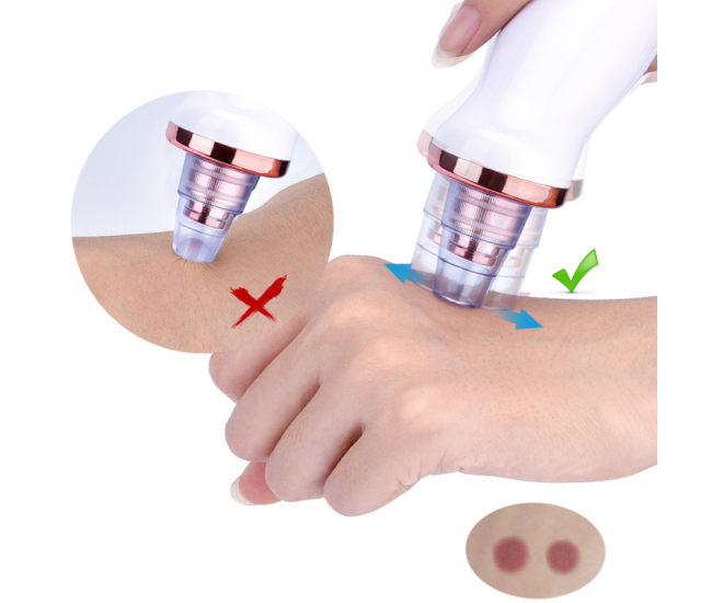 Aspirator facial Lila Care, ingrijire ten, indepartarea punctelor negre, minimizarea porilor, putere de aspirare mare, 3 nivele de rezistenta, 5 capete inlocuibile, portabil, alb