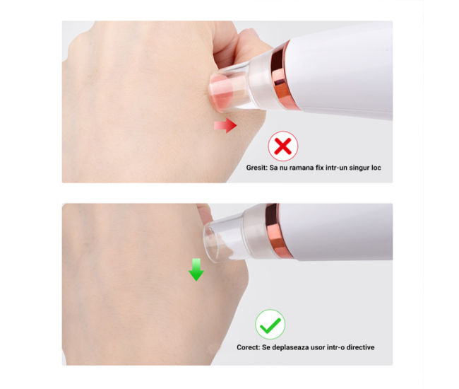 Aspirator facial Lila Care, ingrijire ten, indepartarea punctelor negre, minimizarea porilor, putere de aspirare mare, 6 capete inlocuibile, 7 nivele de rezistenta, portabil, alb