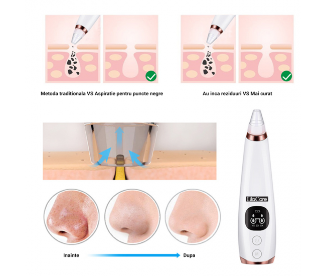 Aspirator facial Lila Care, ingrijire ten, indepartarea punctelor negre, minimizarea porilor, putere de aspirare mare, 6 capete inlocuibile, 7 nivele de rezistenta, portabil, alb